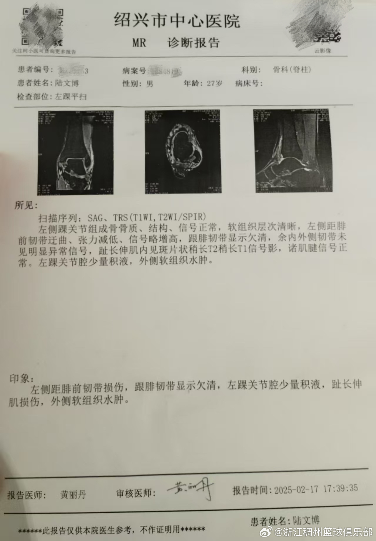 大联赛金靴